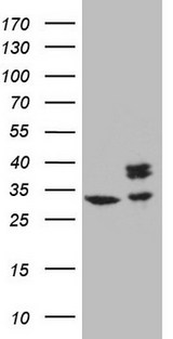 SDHB Antibody - HEK293T cells were transfected with the pCMV6-ENTRY control. (Left lane) or pCMV6-ENTRY SDHB. (Right lane) cDNA for 48 hrs and lysed