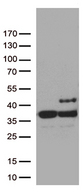 SDHB Antibody - HEK293T cells were transfected with the pCMV6-ENTRY control. (Left lane) or pCMV6-ENTRY SDHB. (Right lane) cDNA for 48 hrs and lysed. Equivalent amounts of cell lysates. (5 ug per lane) were separated by SDS-PAGE and immunoblotted with anti-SDHB mouse monoclonal antibody.1:500