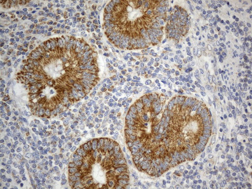SDHB Antibody - Immunohistochemical staining of paraffin-embedded Human appendix tissue within the normal limits using anti-SDHB mouse monoclonal antibody. (Heat-induced epitope retrieval by 1mM EDTA in 10mM Tris buffer. (pH8.0) at 120°C for 2.5 min. (1:300)