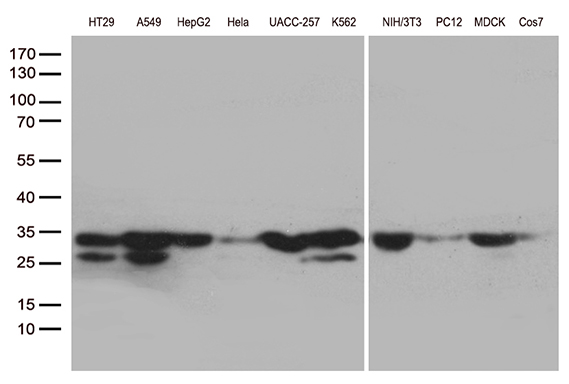 SDHB Antibody - Western blot analysis of extracts. (35ug) from 10 different cell lines by using anti-SDHB monoclonal antibody. 1:500