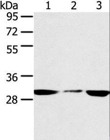 SDHB Antibody - Western blot analysis of PC3 and hepg2 cell, human fetal liver tissue, using SDHB Polyclonal Antibody at dilution of 1:400.