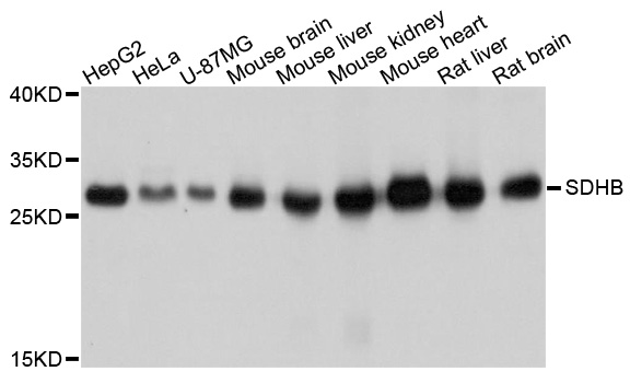 SDHB Antibody - Western blot analysis of extracts of various cell lines, using SDHB antibody at 1:1000 dilution. The secondary antibody used was an HRP Goat Anti-Rabbit IgG (H+L) at 1:10000 dilution. Lysates were loaded 25ug per lane and 3% nonfat dry milk in TBST was used for blocking. An ECL Kit was used for detection and the exposure time was 1s.