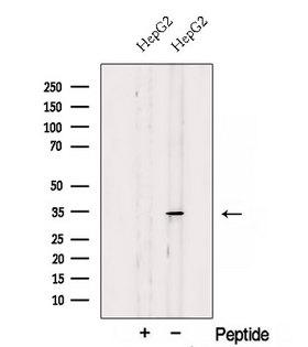 SDHB Antibody - Western blot analysis of extracts of HepG2 cells using SDHB antibody. The lane on the left was treated with blocking peptide.
