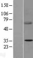 SDHB Protein - Western validation with an anti-DDK antibody * L: Control HEK293 lysate R: Over-expression lysate