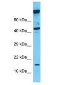 SDHC Antibody - SDHC antibody Western Blot of NCI-H226. Antibody dilution: 1 ug/ml.  This image was taken for the unconjugated form of this product. Other forms have not been tested.