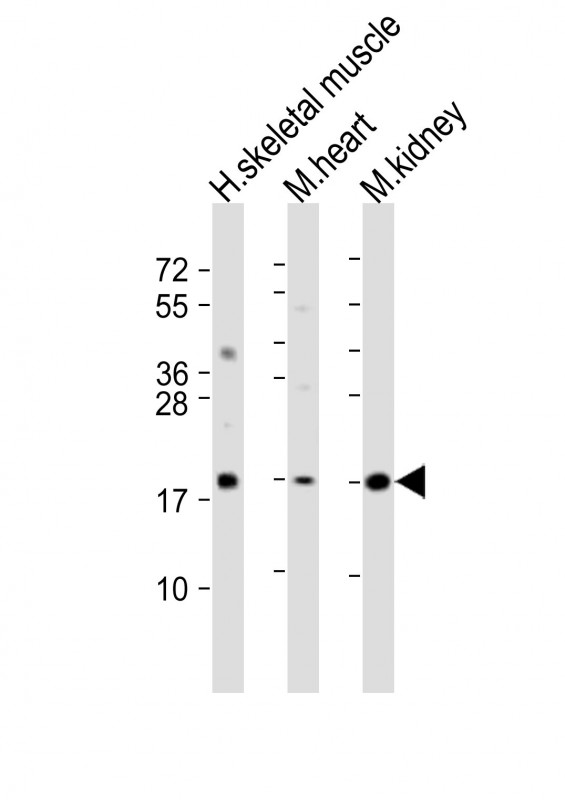 SDHC Antibody - All lanes: Anti-SDHC Antibody (C-Term) at 1:2000 dilution. Lane 1: human skeletal muscle lysate. Lane 2: mouse heart lysate. Lane 3: mouse kidney lysate Lysates/proteins at 20 ug per lane. Secondary Goat Anti-Rabbit IgG, (H+L), Peroxidase conjugated at 1:10000 dilution. Predicted band size: 19 kDa. Blocking/Dilution buffer: 5% NFDM/TBST.