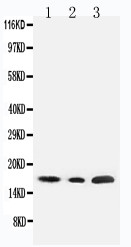 SDHC Antibody - WB of SDHC antibody. All lanes: Anti-SDHC at 0.5ug/ml. Lane 1: Rat Liver Tissue Lysate at 40ug. Lane 2: HELA Tissue Lysate at 40ug. Lane 3: JURKAT Whole Cell Lysate at 40ug. Predicted bind size: 17KD. Observed bind size: 17KD.