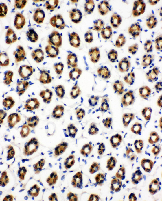 SDHC Antibody - SDHC antibody. IHC(P): Rat Gaster Tissue.