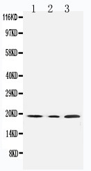 SDHC Antibody - Anti-SDHC antibody, Western blotting All lanes: Anti SDHC at 0.5ug/ml Lane 1: Rat Liver Tissue Lysate at 50ug Lane 2: Mouse Liver Tissue Lysate at 50ug Lane 3: HELA Whole Cell Lysate at 40ug Predicted bind size: 19KD Observed bind size: 19KD