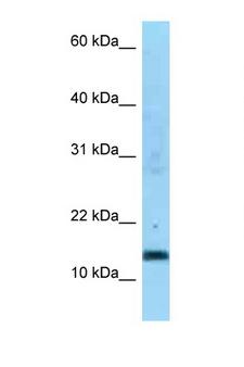 SDHC Antibody - SDHC antibody Western blot of 1 Cell lysate. Antibody concentration 1 ug/ml.  This image was taken for the unconjugated form of this product. Other forms have not been tested.