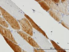SDHC Antibody - Immunoperoxidase of monoclonal antibody to SDHC on formalin-fixed paraffin-embedded human skeletal muscle (antibody concentration 3 ug/ml).