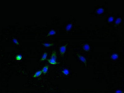 SDHC Antibody - Immunofluorescent analysis of HepG2 cells using SDHC Antibody at dilution of 1:100 and Alexa Fluor 488-congugated AffiniPure Goat Anti-Rabbit IgG(H+L)