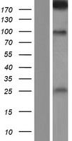 SDK2 Protein - Western validation with an anti-DDK antibody * L: Control HEK293 lysate R: Over-expression lysate