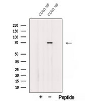 SDR / SDPR Antibody - Western blot analysis of extracts of COLO 320 cells using SDPR antibody. The lane on the left was treated with blocking peptide.