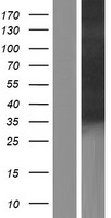 SDR / SDPR Protein - Western validation with an anti-DDK antibody * L: Control HEK293 lysate R: Over-expression lysate