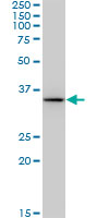 SDR9C1 / BDH1 Antibody - BDH1 monoclonal antibody (M03), clone 4B3. Western Blot analysis of BDH1 expression in Raw 264.7.
