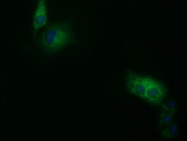 SDR9C7 Antibody - Anti-SDR9C7 mouse monoclonal antibody  immunofluorescent staining of COS7 cells transiently transfected by pCMV6-ENTRY SDR9C7.