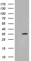 SDR9C7 Antibody - HEK293T cells were transfected with the pCMV6-ENTRY control (Left lane) or pCMV6-ENTRY SDR9C7 (Right lane) cDNA for 48 hrs and lysed. Equivalent amounts of cell lysates (5 ug per lane) were separated by SDS-PAGE and immunoblotted with anti-SDR9C7.