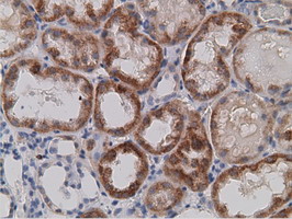 SDR9C7 Antibody - IHC of paraffin-embedded Human Kidney tissue using anti-SDR9C7 mouse monoclonal antibody.