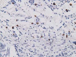 SDR9C7 Antibody - IHC of paraffin-embedded Human bladder tissue using anti-SDR9C7 mouse monoclonal antibody.