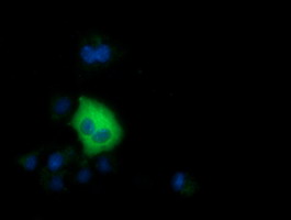 SDR9C7 Antibody - Anti-SDR9C7 mouse monoclonal antibody  immunofluorescent staining of COS7 cells transiently transfected by pCMV6-ENTRY SDR9C7.
