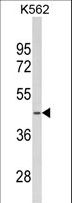 SDS Antibody - Western blot of SDS Antibody in K562 cell line lysates (35 ug/lane). SDS (arrow) was detected using the purified antibody.