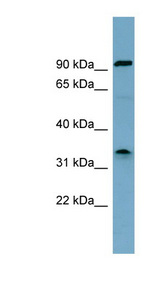 SDS Antibody - SDS antibody Western blot of HT1080 cell lysate. This image was taken for the unconjugated form of this product. Other forms have not been tested.