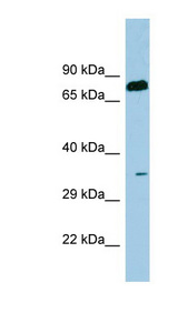 SDS Antibody - SDS antibody Western blot of Fetal Thymus lysate. This image was taken for the unconjugated form of this product. Other forms have not been tested.