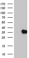 SDS Antibody - HEK293T cells were transfected with the pCMV6-ENTRY control (Left lane) or pCMV6-ENTRY SDS (Right lane) cDNA for 48 hrs and lysed. Equivalent amounts of cell lysates (5 ug per lane) were separated by SDS-PAGE and immunoblotted with anti-SDS.