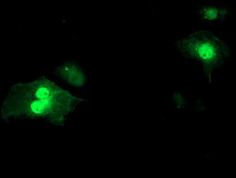 SDS Antibody - Anti-SDS mouse monoclonal antibody immunofluorescent staining of COS7 cells transiently transfected by pCMV6-ENTRY SDS.