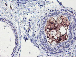 SDS Antibody - IHC of paraffin-embedded Human breast tissue using anti-SDS mouse monoclonal antibody.