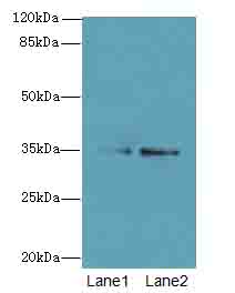 SDSL / Serine Dehydratase-Like Antibody - Western blot. All lanes: SDSL antibody at 4 ug/ml. Lane 1: HepG-2 whole cell lysate. Lane 2: Mouse liver tissue. Secondary Goat polyclonal to Rabbit IgG at 1:10000 dilution. Predicted band size: 35 kDa. Observed band size: 35 kDa.