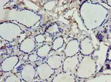 SDSL / Serine Dehydratase-Like Antibody - Immunohistochemistry of paraffin-embedded human thyroid tissue using antibody at dilution of 1:100.