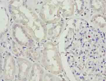 SDSL / Serine Dehydratase-Like Antibody - Immunohistochemistry of paraffin-embedded human kidney tissue using antibody at dilution of 1:100.