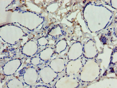 SDSL / Serine Dehydratase-Like Antibody - Immunohistochemistry of paraffin-embedded human thyroid tissue using SDSL Antibody at dilution of 1:100