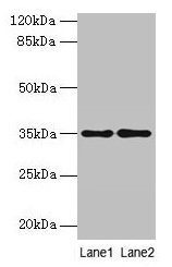 SDSL / Serine Dehydratase-Like Antibody - Western blot All lanes: SDSL antibody at 4µg/ml Lane 1: HepG2 whole cell lysate Lane 2: Mouse liver tissue Secondary Goat polyclonal to rabbit IgG at 1/10000 dilution Predicted band size: 35 kDa Observed band size: 35 kDa