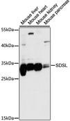 SDSL / Serine Dehydratase-Like Antibody - Western blot analysis of extracts of various cell lines, using SDSL antibody at 1:1000 dilution. The secondary antibody used was an HRP Goat Anti-Rabbit IgG (H+L) at 1:10000 dilution. Lysates were loaded 25ug per lane and 3% nonfat dry milk in TBST was used for blocking. An ECL Kit was used for detection and the exposure time was 5s.