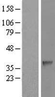 SDSL / Serine Dehydratase-Like Protein - Western validation with an anti-DDK antibody * L: Control HEK293 lysate R: Over-expression lysate