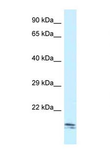 SEC11C Antibody - SEC11C antibody Western blot of Small Intestine lysate. Antibody concentration 1 ug/ml.  This image was taken for the unconjugated form of this product. Other forms have not been tested.