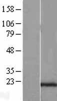 SEC11C Protein - Western validation with an anti-DDK antibody * L: Control HEK293 lysate R: Over-expression lysate