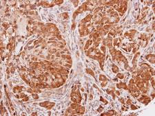 SEC13 Antibody - IHC of paraffin-embedded A549 xenograft using SEC13L1 antibody at 1:100 dilution.