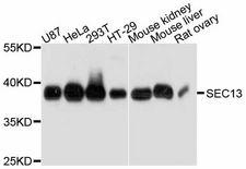 SEC13 Antibody - Western blot analysis of extracts of various cell lines, using SEC13 antibody at 1:3000 dilution. The secondary antibody used was an HRP Goat Anti-Rabbit IgG (H+L) at 1:10000 dilution. Lysates were loaded 25ug per lane and 3% nonfat dry milk in TBST was used for blocking. An ECL Kit was used for detection and the exposure time was 10s.