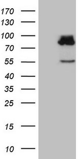 SEC14L1 Antibody - HEK293T cells were transfected with the pCMV6-ENTRY control. (Left lane) or pCMV6-ENTRY SEC14L1. (Right lane) cDNA for 48 hrs and lysed. Equivalent amounts of cell lysates. (5 ug per lane) were separated by SDS-PAGE and immunoblotted with anti-SEC14L1. (1:2000)