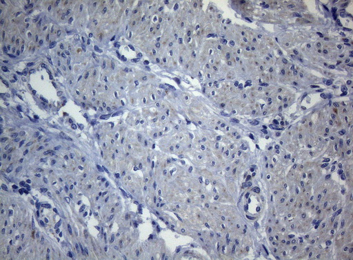 SEC14L1 Antibody - Immunohistochemical staining of paraffin-embedded Human endometrium tissue within the normal limits using anti-SEC14L1 mouse monoclonal antibody. (Heat-induced epitope retrieval by 1mM EDTA in 10mM Tris buffer. (pH8.5) at 120°C for 3 min. (1:150)
