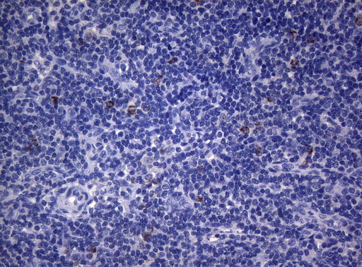 SEC14L1 Antibody - Immunohistochemical staining of paraffin-embedded Human lymph node tissue within the normal limits using anti-SEC14L1 mouse monoclonal antibody. (Heat-induced epitope retrieval by 1mM EDTA in 10mM Tris buffer. (pH8.5) at 120°C for 3 min. (1:150)