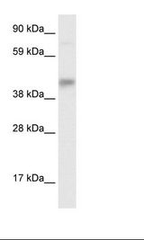 SEC14L2 Antibody - Fetal Liver Lysate.  This image was taken for the unconjugated form of this product. Other forms have not been tested.