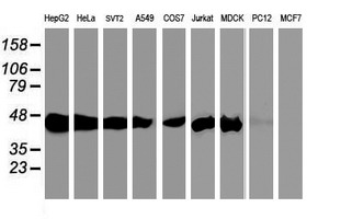 SEC14L2 Antibody - Western blot of extracts (35 ug) from 9 different cell lines by using anti-SEC14L2 monoclonal antibody.