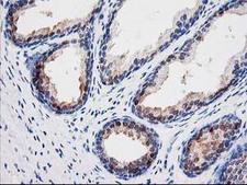 SEC14L2 Antibody - IHC of paraffin-embedded Human prostate tissue using anti-SEC14L2 mouse monoclonal antibody.