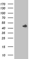 SEC14L2 Antibody - HEK293T cells were transfected with the pCMV6-ENTRY control (Left lane) or pCMV6-ENTRY SEC14L2 (Right lane) cDNA for 48 hrs and lysed. Equivalent amounts of cell lysates (5 ug per lane) were separated by SDS-PAGE and immunoblotted with anti-SEC14L2.