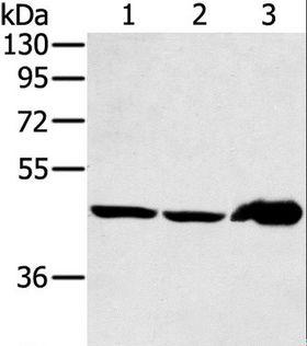 SEC14L2 Antibody - Western blot analysis of Mouse liver tissue and PC3 cell, human fetal liver tissue, using SEC14L2 Polyclonal Antibody at dilution of 1:400.